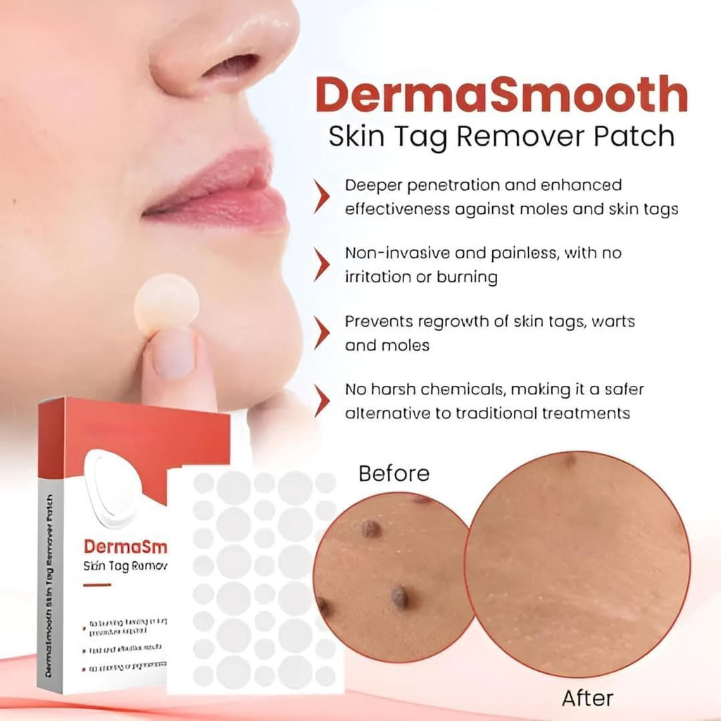 DermaSmooth Skin Tag Remover Original Patch - Painless Patch for Acne & skin tag
